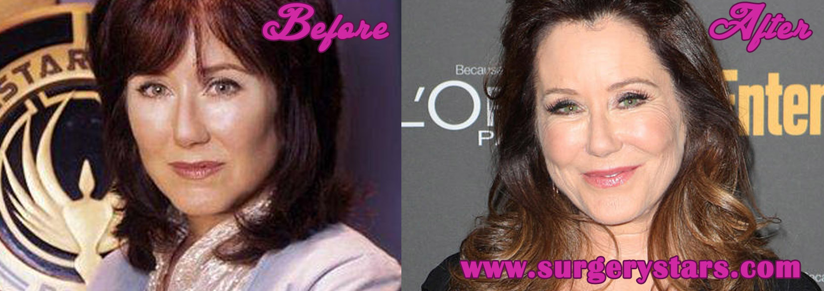 cole loftus recommends mary mcdonnell facelift pic