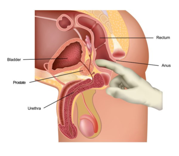 aynun nahar recommends External Prostate Massage Techniques