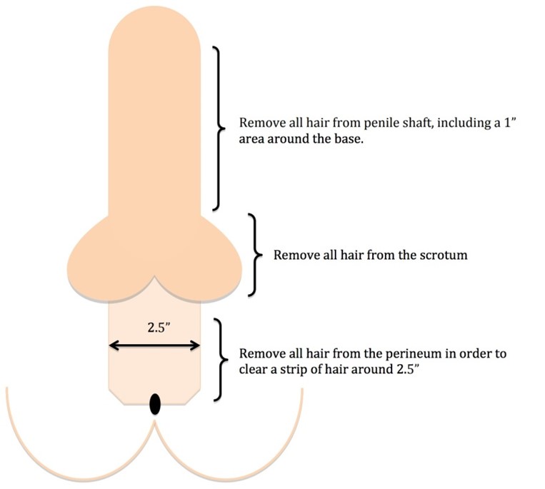 des sim share how to remove hair from pennis permanently photos