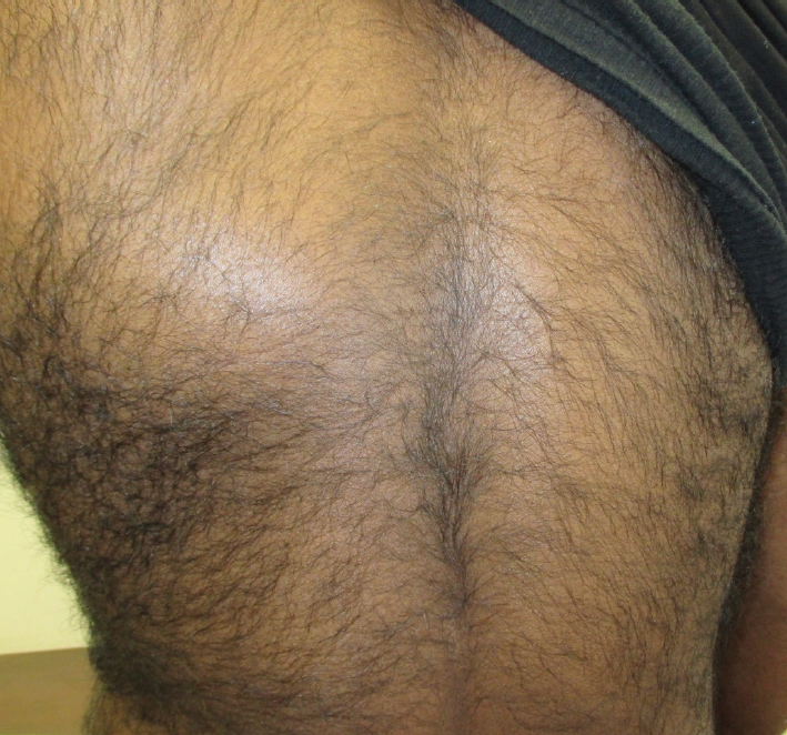 hairy mature close up