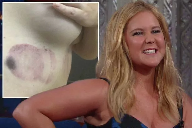 amy proud add photo amy schumer poses topless