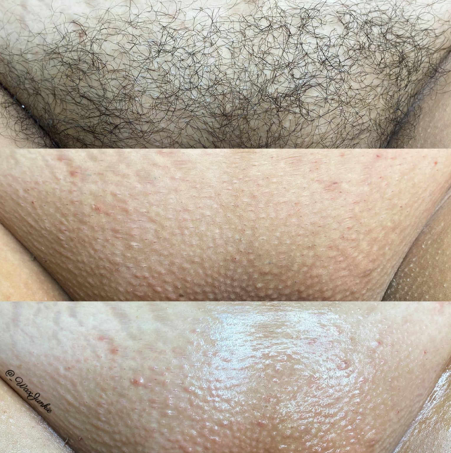 don dupertuis add brazilian wax before and after pictures photo