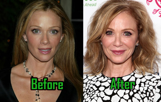 brittany hodgdon recommends lauren holly breast implants pic
