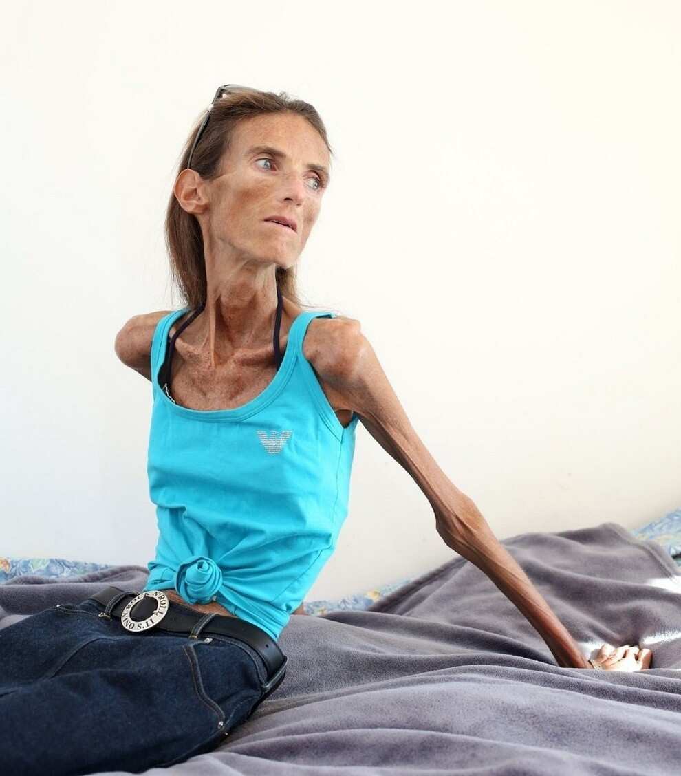Best of Skinniest person in world