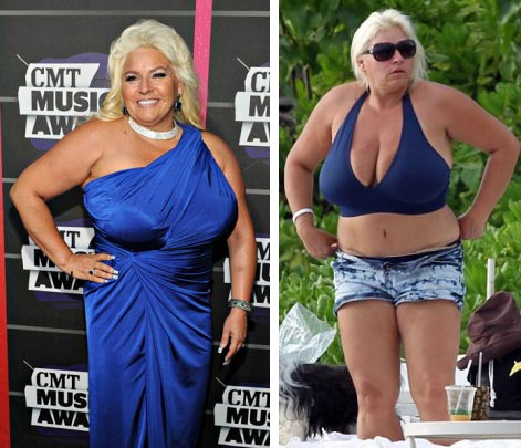 ana de campos add beth chapman boobs photo