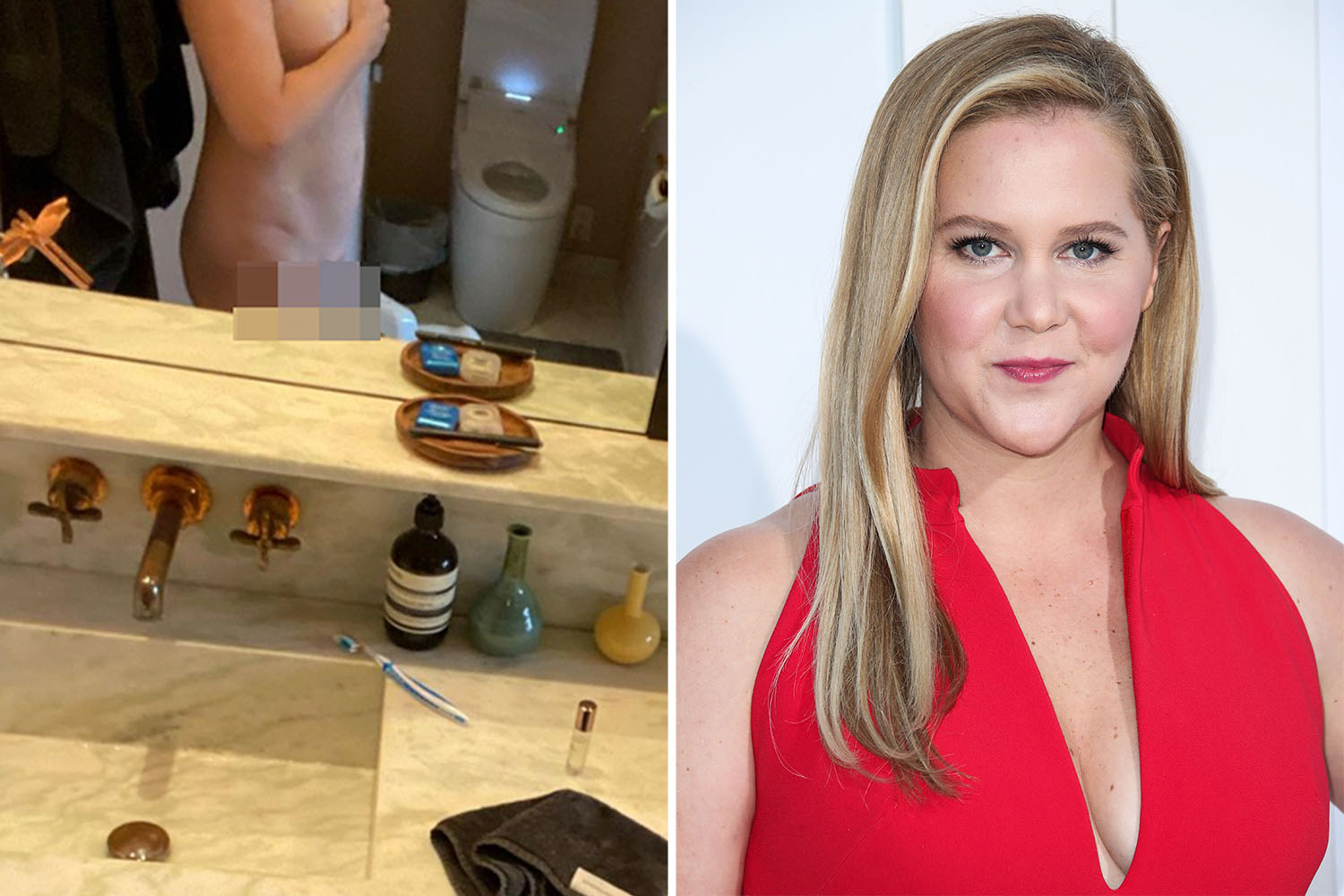 dale kitchin share amy schumer poses topless photos