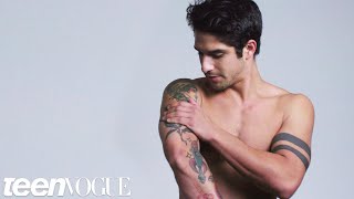 dawn de lange recommends Tyler Posey Tattoo Removal