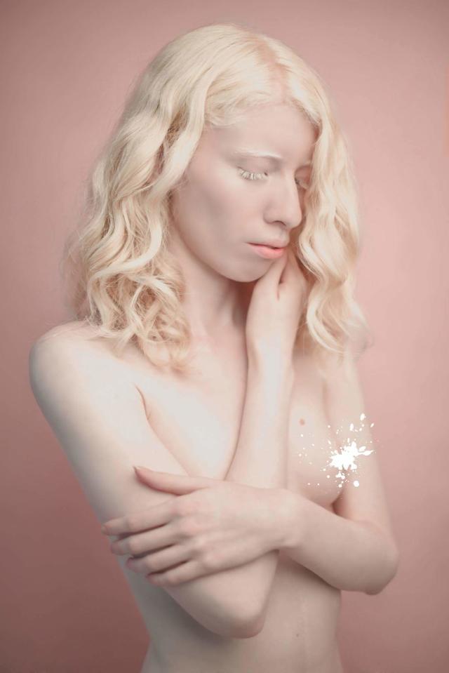 Albino Women Nude usa sex