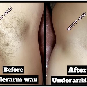 anna liljestrand recommends Brazilian Wax Before And After Pictures