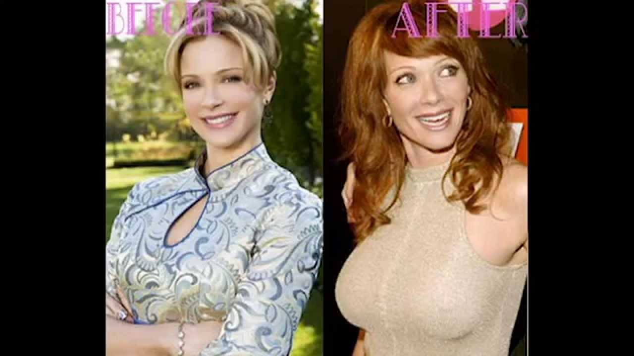 brittany frankowski recommends lauren holly breast implants pic