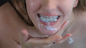 chasity chadwick recommends cum on braces gif pic