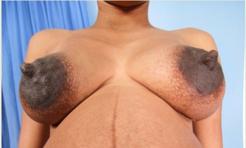 binu chacko recommends big black areola tumblr pic