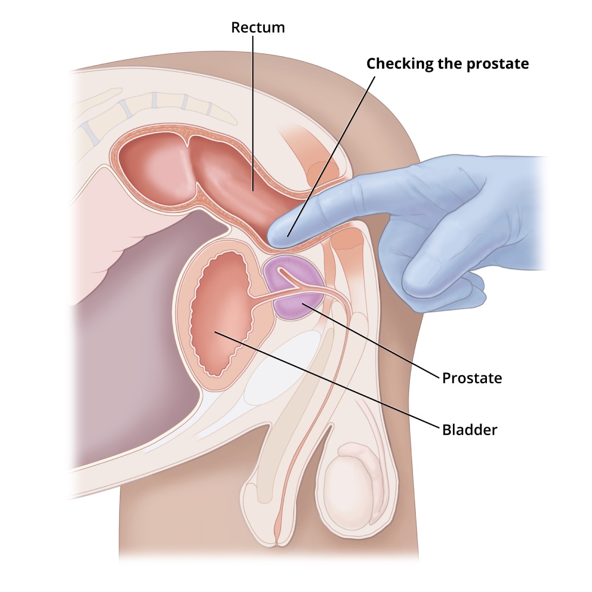 chriz shawn recommends ejaculating during prostate exam pic