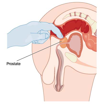brian janowiak recommends Ejaculating During Prostate Exam