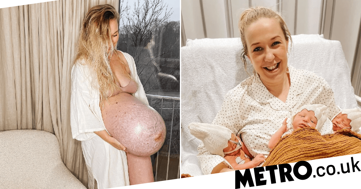 bailey sims recommends Pregnant Bellies With Triplets