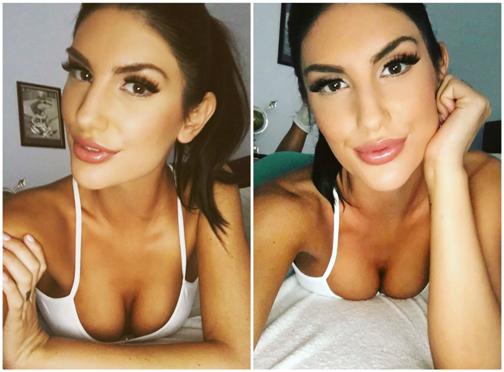 Best of August ames surgery