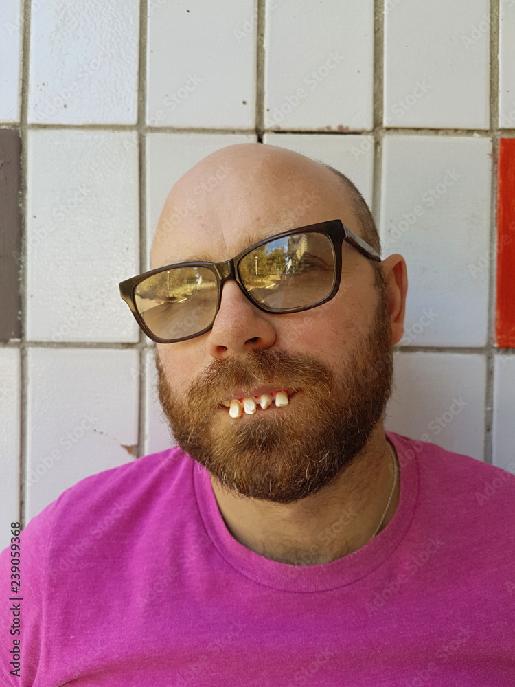 chad younker recommends ugly guy with glasses pic