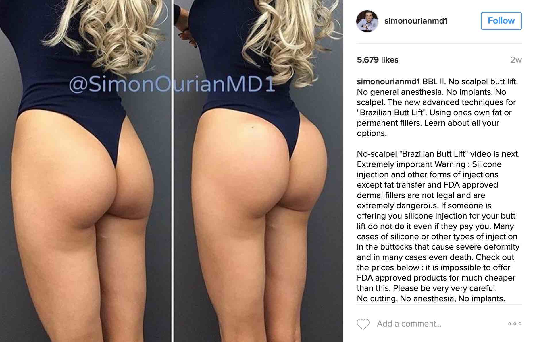 Lisa Ann Butt Implants karter squirt