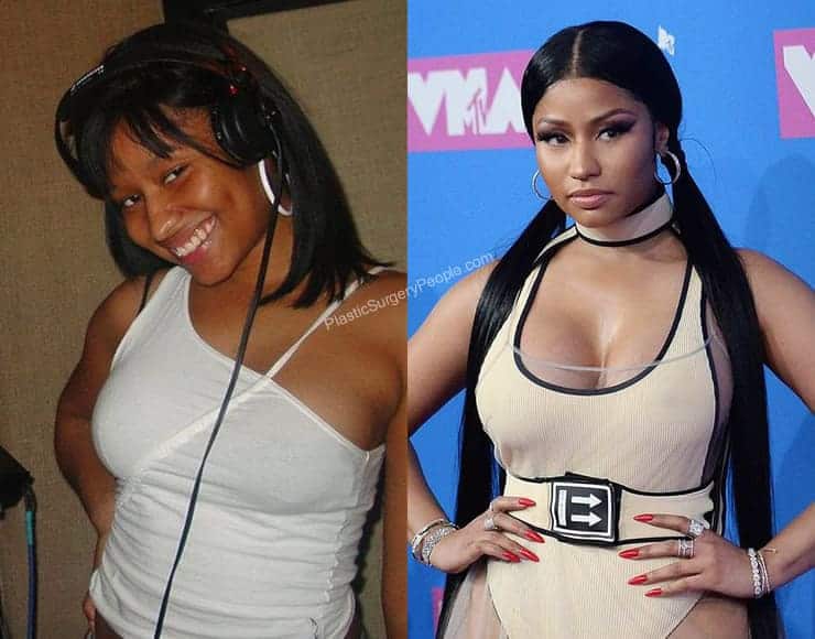 Are Nicki Minaj Breasts Real Or Fake room web