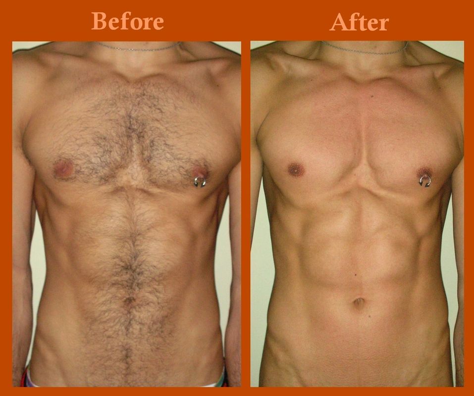 brad huffaker recommends brazilian wax pictures before and after male pic