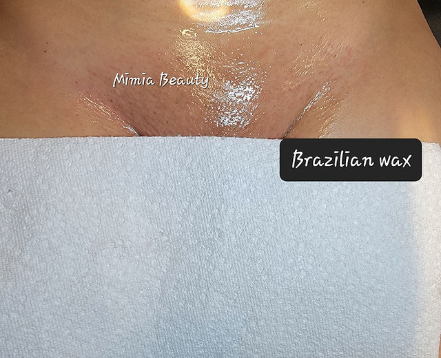 Brazilian Wax Before And After Pictures kaitlyn nude