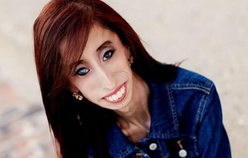 arlene daniel recommends Is Lizzie Velasquez Married