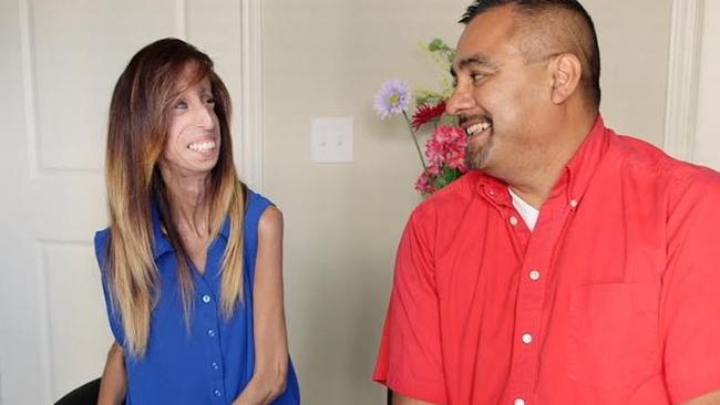 Is Lizzie Velasquez Married asshole lesbian