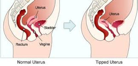 positions to avoid hitting cervix