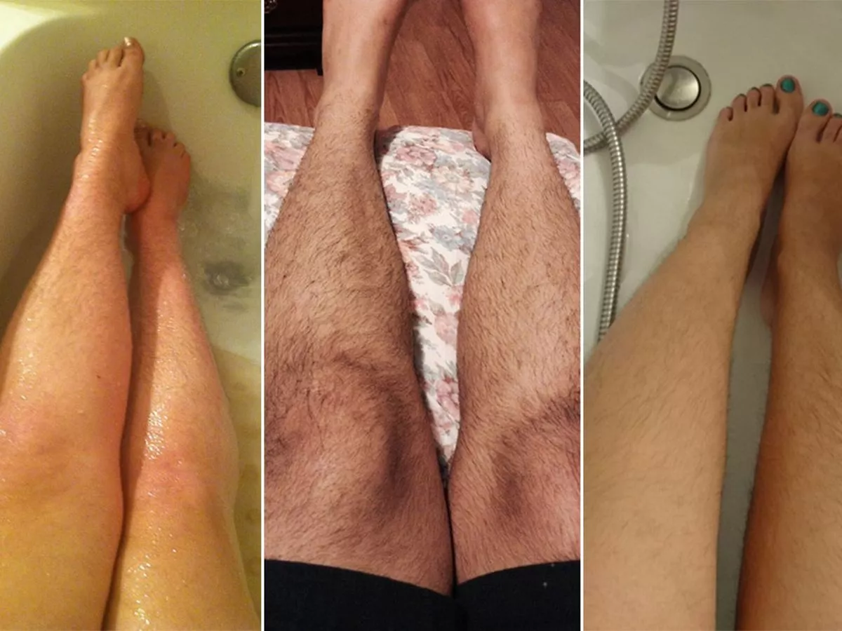 christian keen recommends hairy legs men tumblr pic