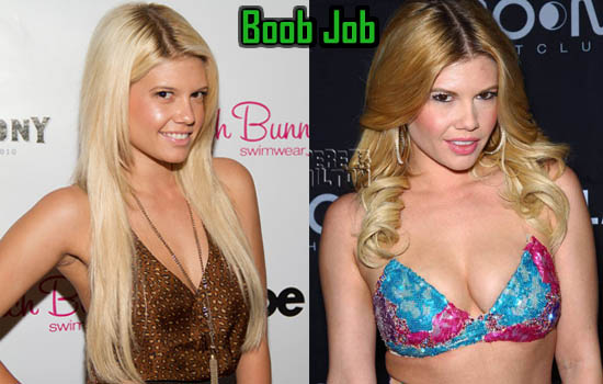 chanel west coast breasts