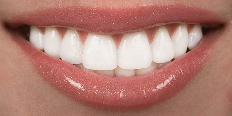 Best of The whitest teeth ever