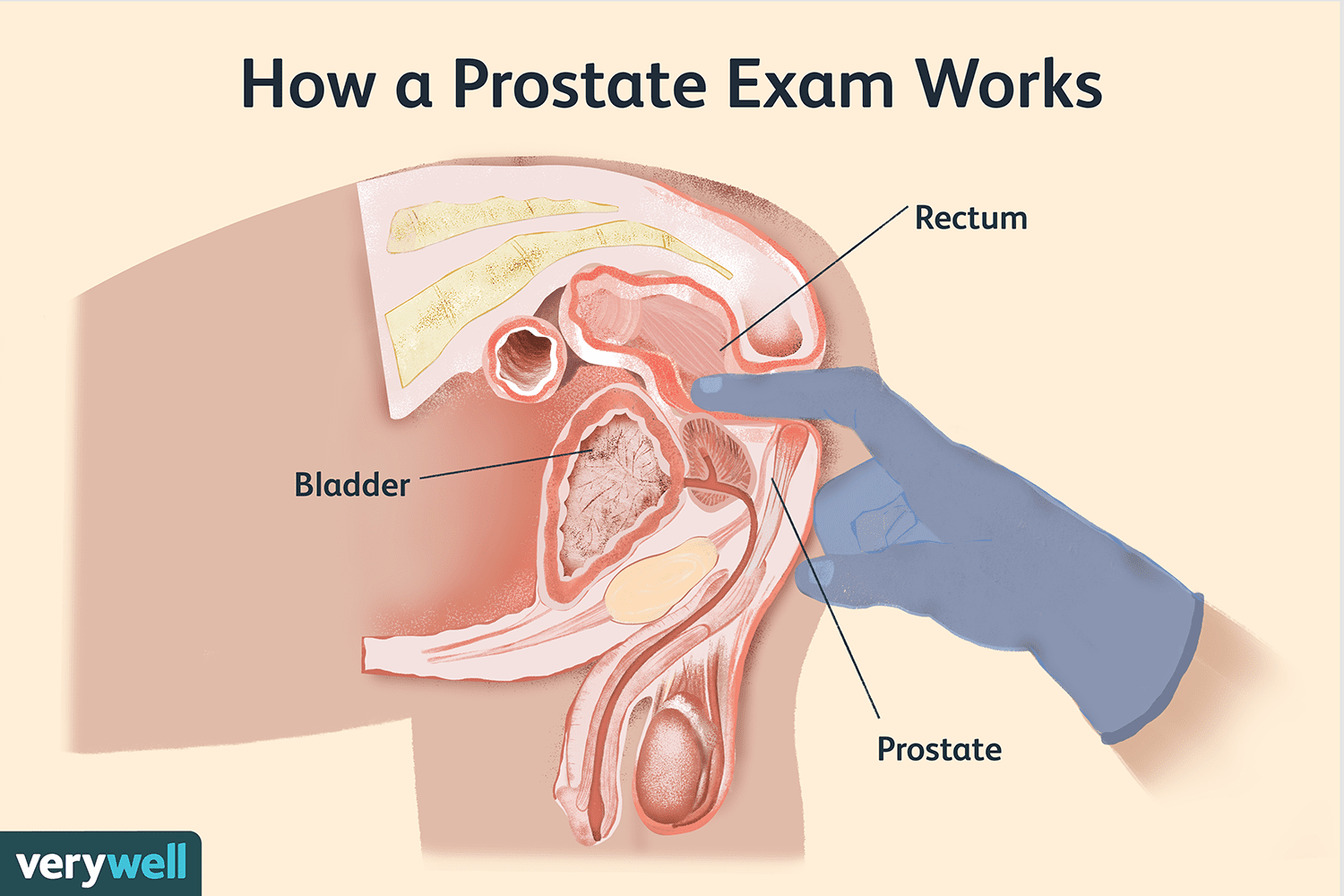 aaron leighow share ejaculating during prostate exam photos