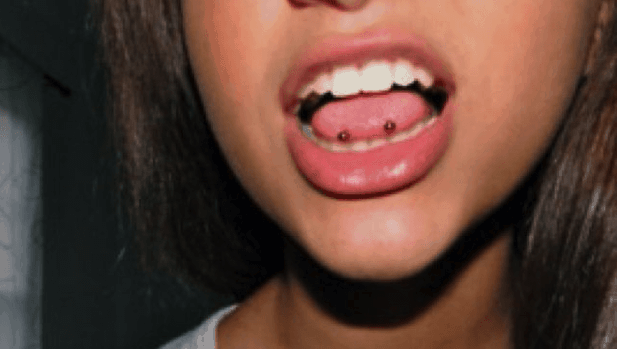 dawn greensmith recommends double tongue piercing tip pic