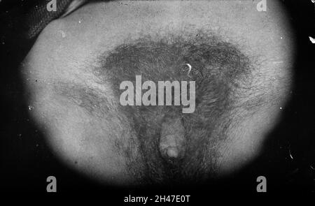 abdullah alfailakawy recommends images of a hermaphrodite pic