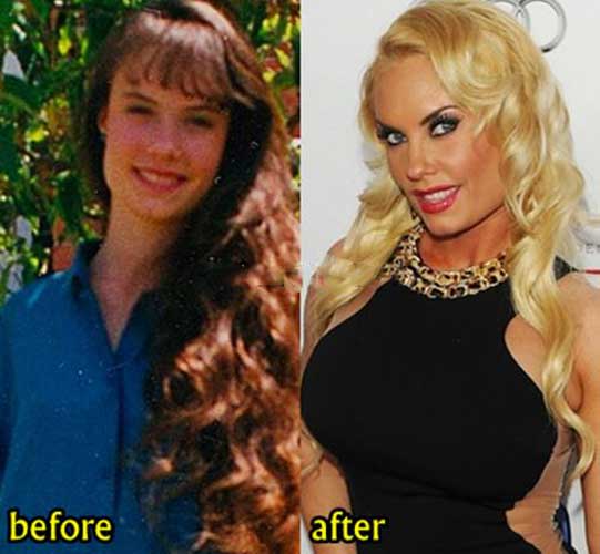debbie rickards recommends Pics Of Coco Austin Before Plastic Surgery