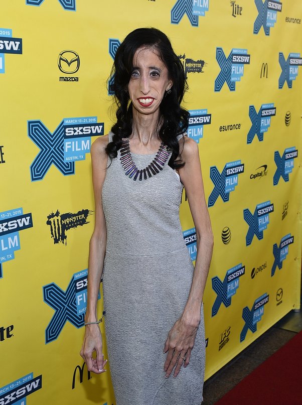 colleen whitmore add photo skinniest person in world