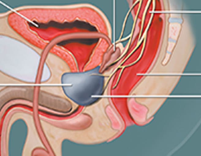 dana leggett recommends ejaculating during prostate exam pic