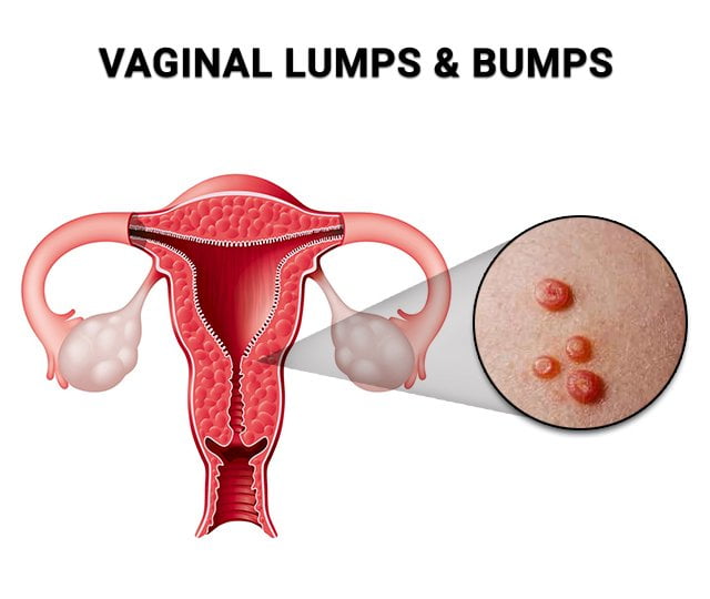 deana d recommends what does a vaginal pump do pic