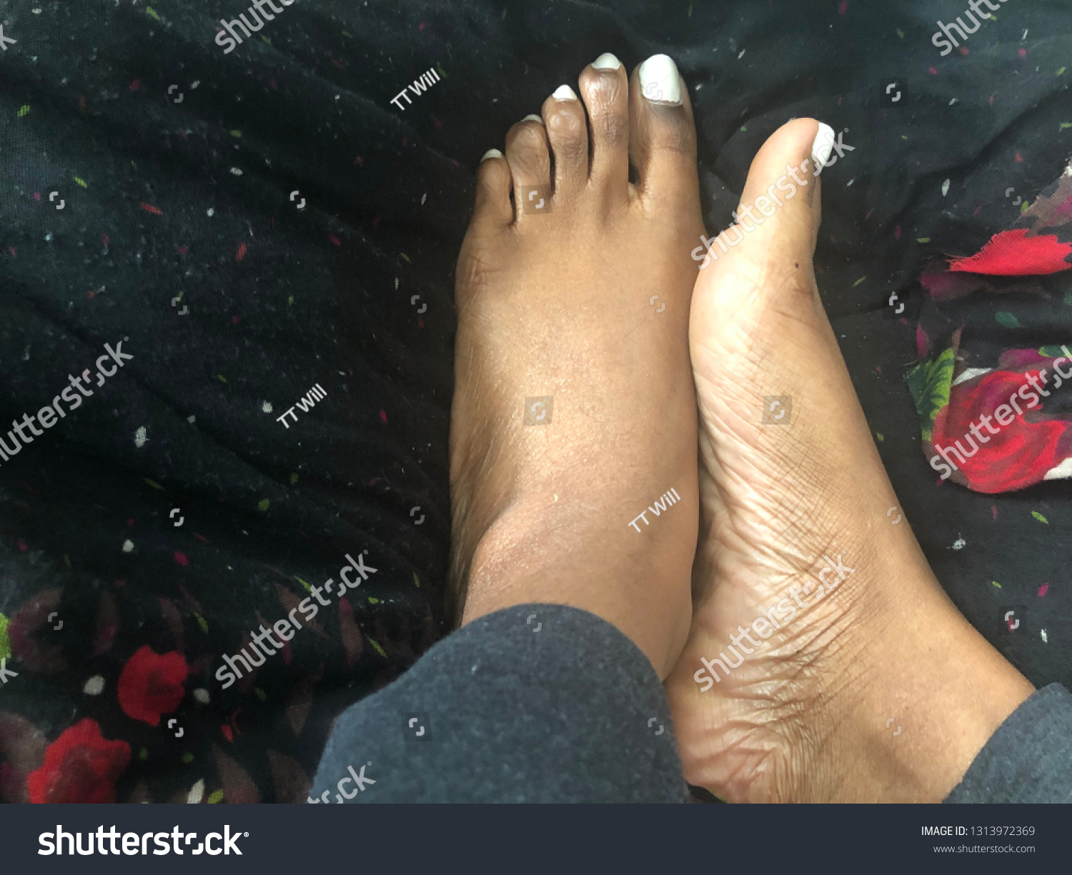 black women foot fetish