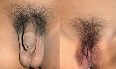dan grund recommends Female Pubic Hair Nude