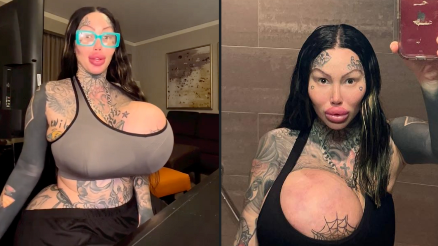 cathy vacek recommends huge fake tits pic