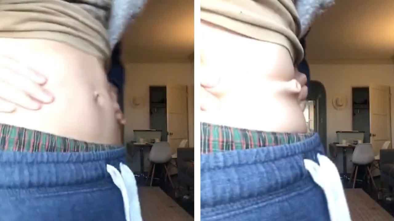 denise luxford add male outie belly button photo