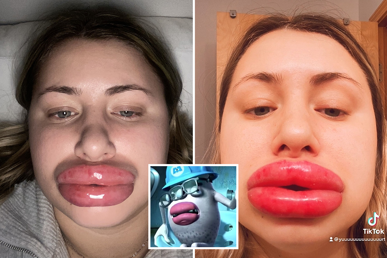 monster inc big lips