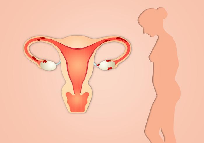 antonette de guzman recommends Positions To Avoid Hitting Cervix