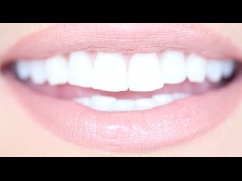 amy luettich recommends The Whitest Teeth Ever
